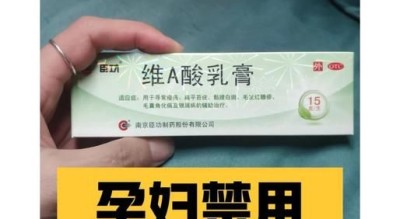 马应龙孕妇能用吗_孕妇痔疮膏安全吗