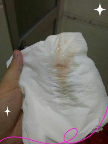 孕妇见红后多久会生_临产见红图片真实表现