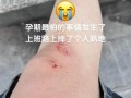孕妇梦见自己摔倒没事_孕妇梦见摔倒预示什么