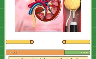 孕妇结石怎么办_孕妇结石对胎儿有影响吗