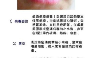 孕妇嘴角长疱疹怎么办_会影响胎儿吗