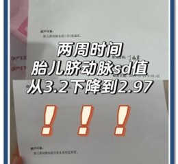 孕妇sd值正常范围_孕妇sd值偏高怎么办