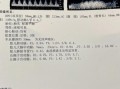 孕妇sd值正常范围_脐动脉sd偏高怎么办