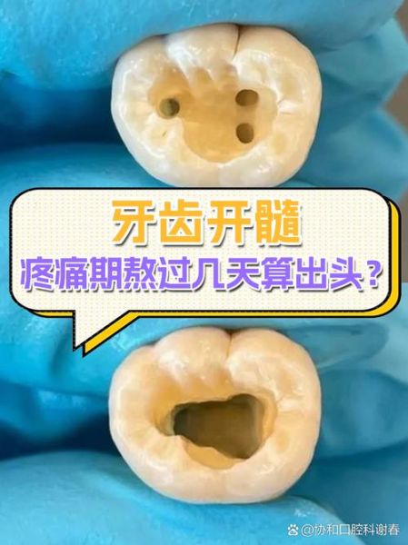 孕妇牙髓炎怎么快速止痛_孕妇牙髓炎止痛方法-第2张图片-星辰妙记 孕妇牙髓炎怎么快速止痛_孕妇牙髓炎止痛方法-第2张图片-星辰妙记