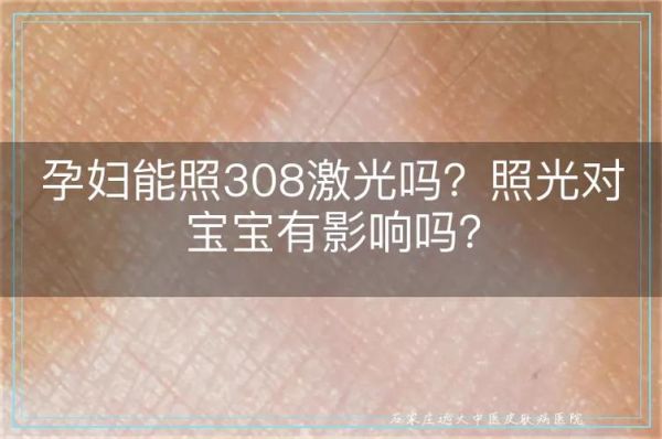 孕妇可以做激光手术吗_孕期激光手术风险-第3张图片-星辰妙记 孕妇可以做激光手术吗_孕期激光手术风险-第3张图片-星辰妙记