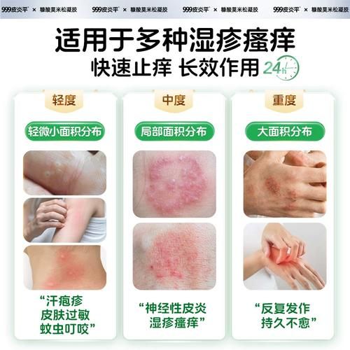 孕妇能用皮炎平软膏吗_孕妇皮炎平软膏安全吗-第3张图片-星辰妙记 孕妇能用皮炎平软膏吗_孕妇皮炎平软膏安全吗-第3张图片-星辰妙记