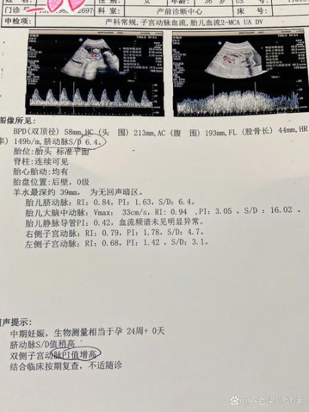 孕妇sd值正常范围_脐动脉sd偏高怎么办-第1张图片-星辰妙记 孕妇sd值正常范围_脐动脉sd偏高怎么办-第1张图片-星辰妙记