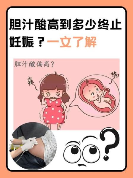 孕妇胆汁酸高对胎儿有什么影响_孕妇胆汁酸高怎么办-第1张图片-星辰妙记 孕妇胆汁酸高对胎儿有什么影响_孕妇胆汁酸高怎么办-第1张图片-星辰妙记