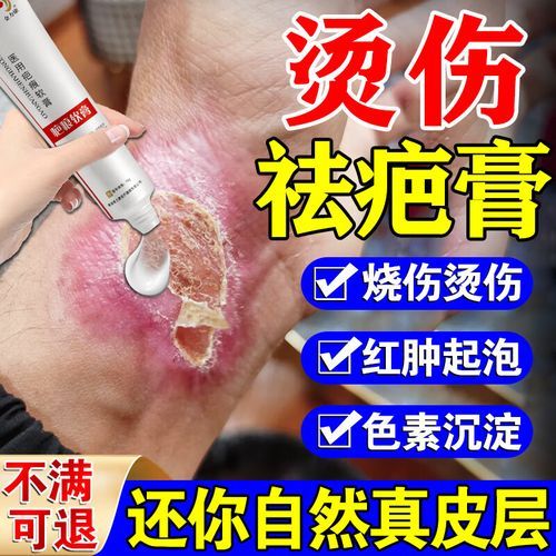 孕妇可以用烫伤药膏吗_孕妇烫伤后用什么药安全-第2张图片-星辰妙记 孕妇可以用烫伤药膏吗_孕妇烫伤后用什么药安全-第2张图片-星辰妙记