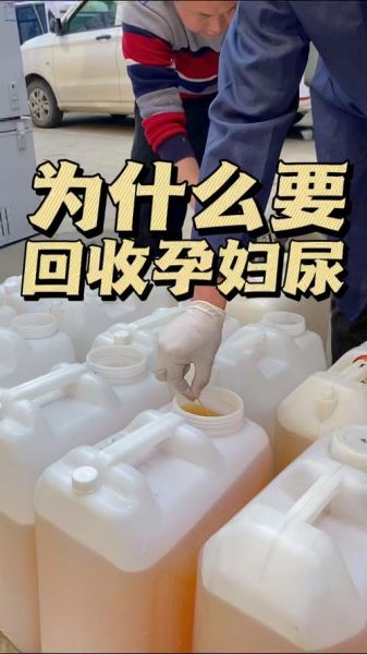 孕妇尿液味道很重_正常吗-第1张图片-星辰妙记 孕妇尿液味道很重_正常吗-第1张图片-星辰妙记