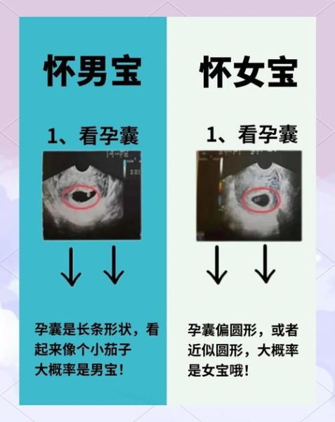 孕妇用一根筷子测男女准吗_民间方法科学解释-第2张图片-星辰妙记 孕妇用一根筷子测男女准吗_民间方法科学解释-第2张图片-星辰妙记