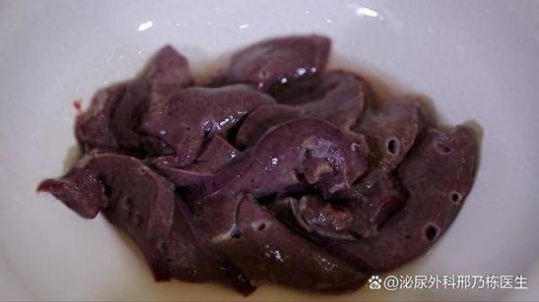 孕妇能吃猪肝吗_孕妇吃猪肝对胎儿好吗-第2张图片-星辰妙记 孕妇能吃猪肝吗_孕妇吃猪肝对胎儿好吗-第2张图片-星辰妙记
