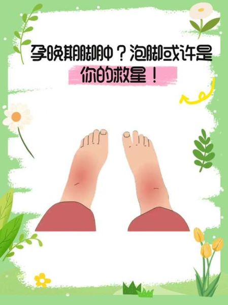 孕妇脚累是怎么回事_如何缓解-第1张图片-星辰妙记