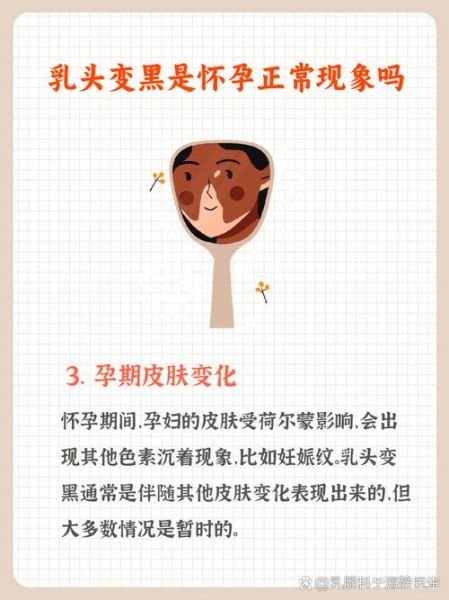 孕妇乳头变黑正常吗_孕妇乳头护理方法-第2张图片-星辰妙记 孕妇乳头变黑正常吗_孕妇乳头护理方法-第2张图片-星辰妙记