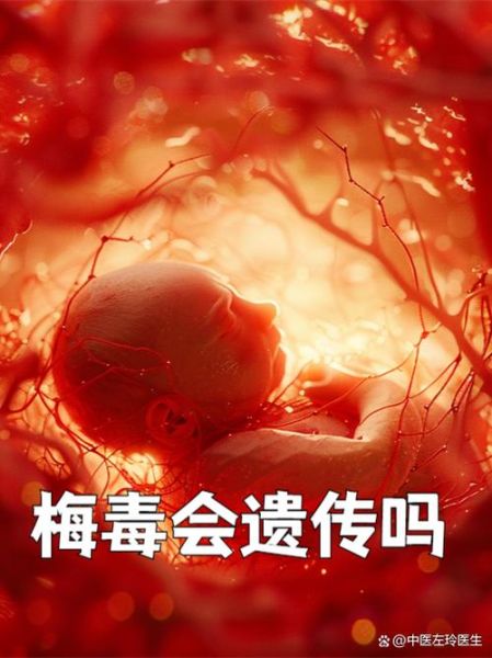 孕妇为什么容易感染梅毒_梅毒对胎儿的影响-第1张图片-星辰妙记 孕妇为什么容易感染梅毒_梅毒对胎儿的影响-第1张图片-星辰妙记
