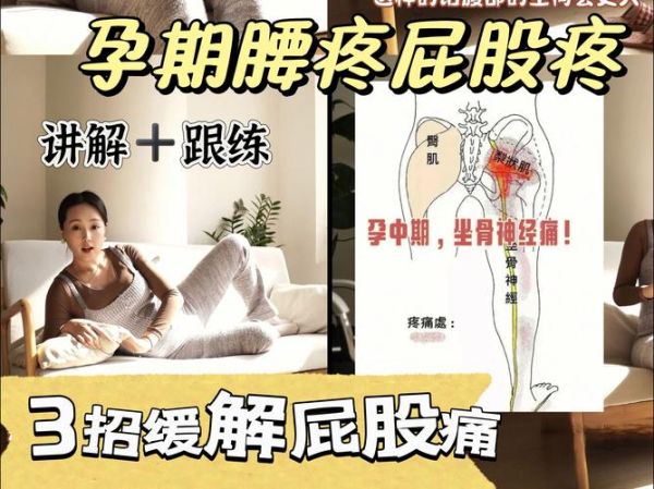 孕妇屁股疼怎么办_孕妇屁股疼怎么缓解-第1张图片-星辰妙记 孕妇屁股疼怎么办_孕妇屁股疼怎么缓解-第1张图片-星辰妙记