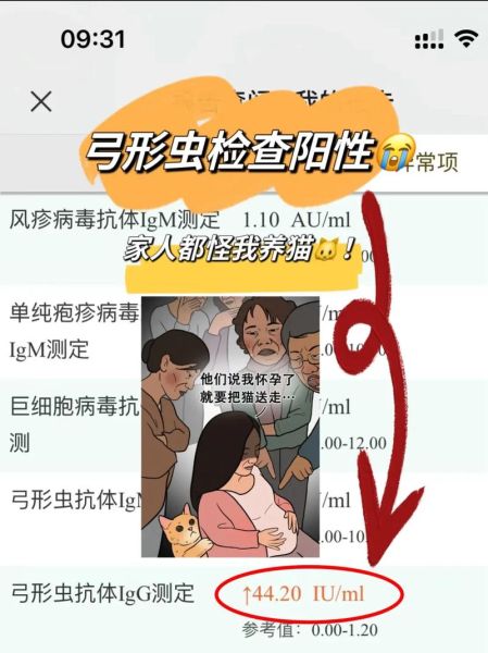 孕妇感染弓形虫的症状_对胎儿有什么影响-第1张图片-星辰妙记 孕妇感染弓形虫的症状_对胎儿有什么影响-第1张图片-星辰妙记