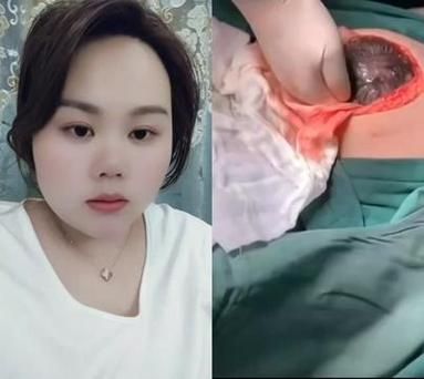 孕妇难产怎么办_难产有哪些症状-第2张图片-星辰妙记 孕妇难产怎么办_难产有哪些症状-第2张图片-星辰妙记