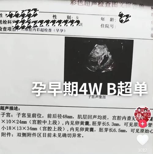 孕妇b超什么时候做_孕妇b超做几次-第3张图片-星辰妙记