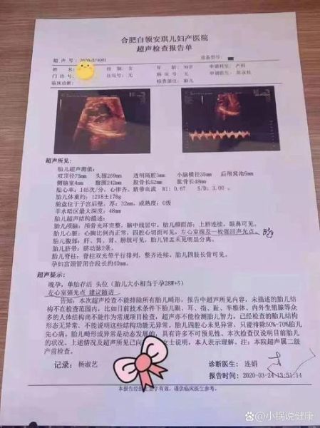 孕妇小排畸检查什么_小排畸几周做最合适-第1张图片-星辰妙记