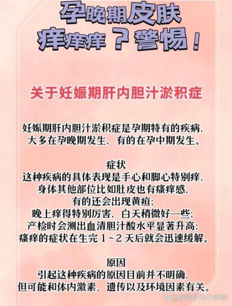 孕妇胆汁淤积是哪里痒_胆汁淤积瘙痒部位图解-第2张图片-星辰妙记 孕妇胆汁淤积是哪里痒_胆汁淤积瘙痒部位图解-第2张图片-星辰妙记