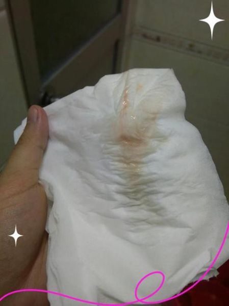 孕妇见红后多久会生_临产见红图片真实表现-第1张图片-星辰妙记