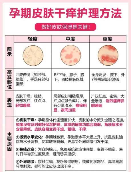 孕妇湿疹对胎儿有影响吗_孕妇湿疹怎么缓解-第2张图片-星辰妙记