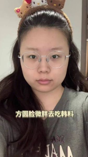 镜头显胖怎么办_如何拍照显瘦-第1张图片-星辰妙记