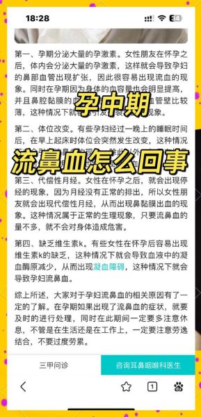 孕妇频繁流鼻血正常吗_孕早期鼻出血怎么办-第1张图片-星辰妙记