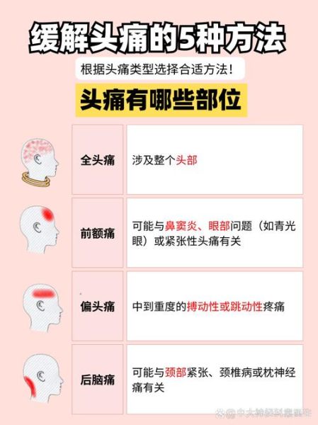 孕妇脑袋疼怎么办_孕妇头痛缓解方法-第3张图片-星辰妙记